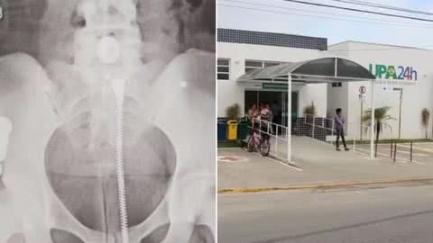 Prefeitura de Itanhaém foi condenada por falta de diagnóstico. - Imagem: Reprodução / Acervo | Divulgação / Prefeitura de Itanhaém