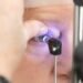 Inteligência artificial pode se tornar aliada no combate ao glaucoma