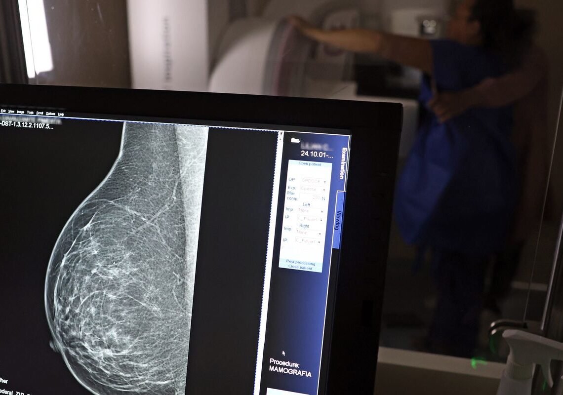 Ministério da Saúde passa a recomendar mamografia a partir dos 40 anos