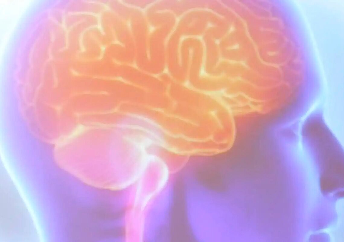 Projeto Ártemis avalia genética de pacientes que sofreram AVC