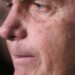 Com crise persistente de soluços, Bolsonaro faz nova cirurgia