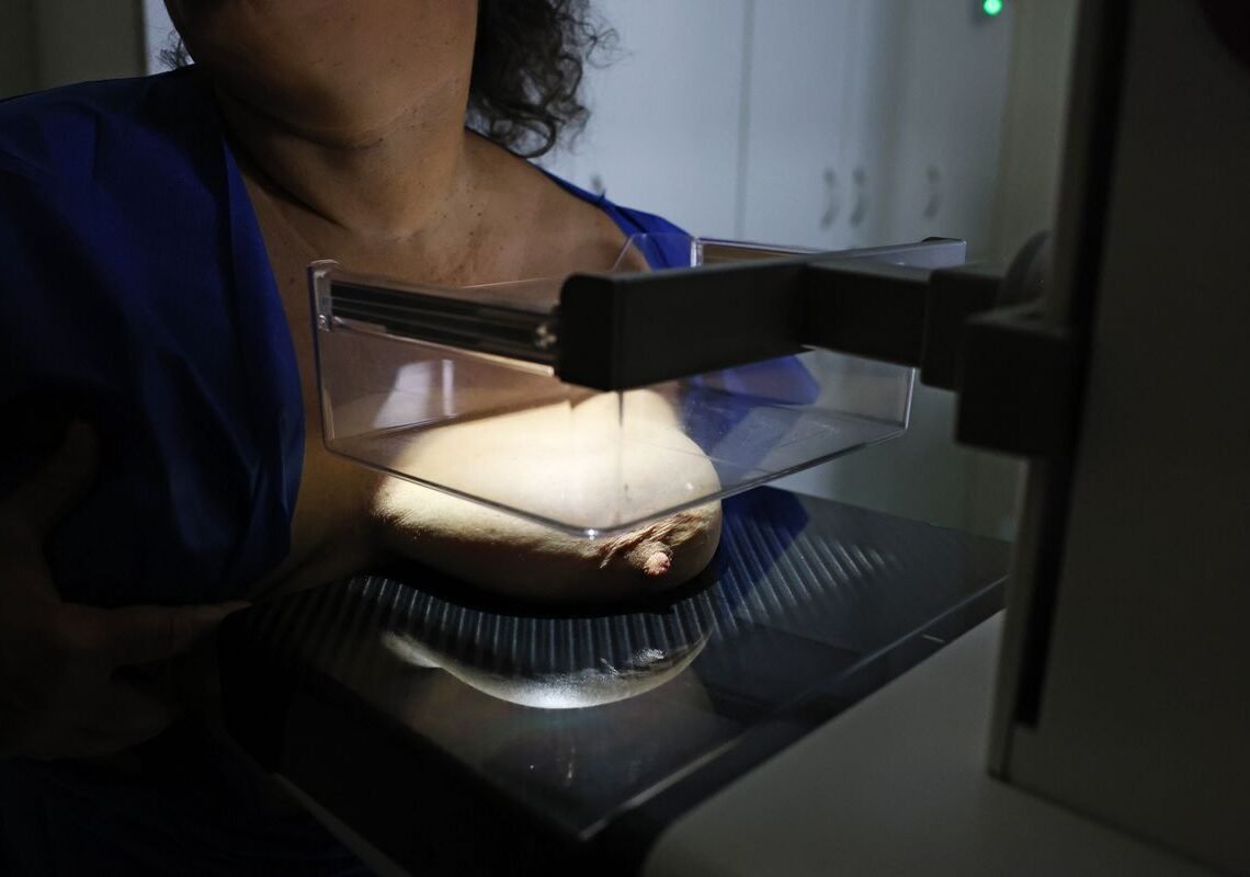Vigitel: 92% das brasileiras entre 50 e 69 anos fizeram mamografia